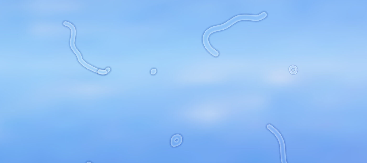 are floaters in the eye dangerous