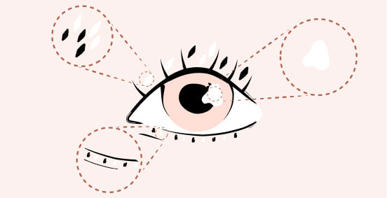 Dry Eye Disease