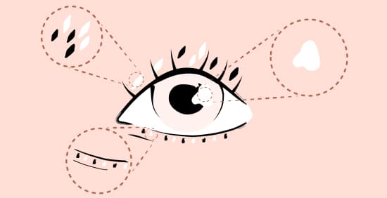 Dry Eye Disease Education