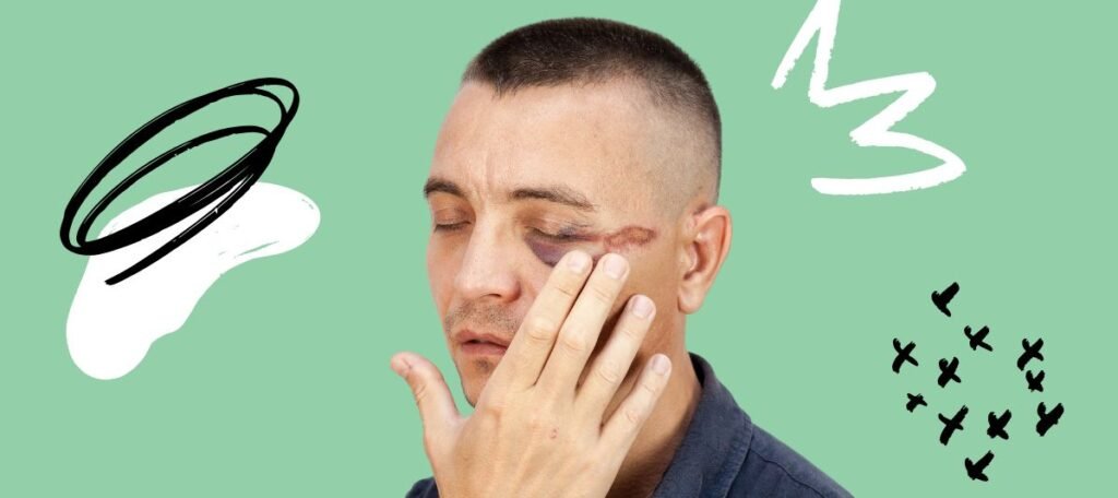 Get Rid of Black Eye Fast