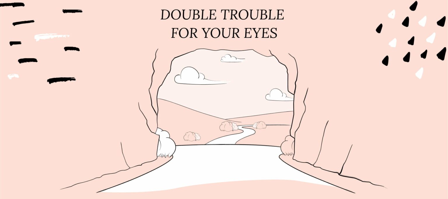 Glaucoma and dry eyes
