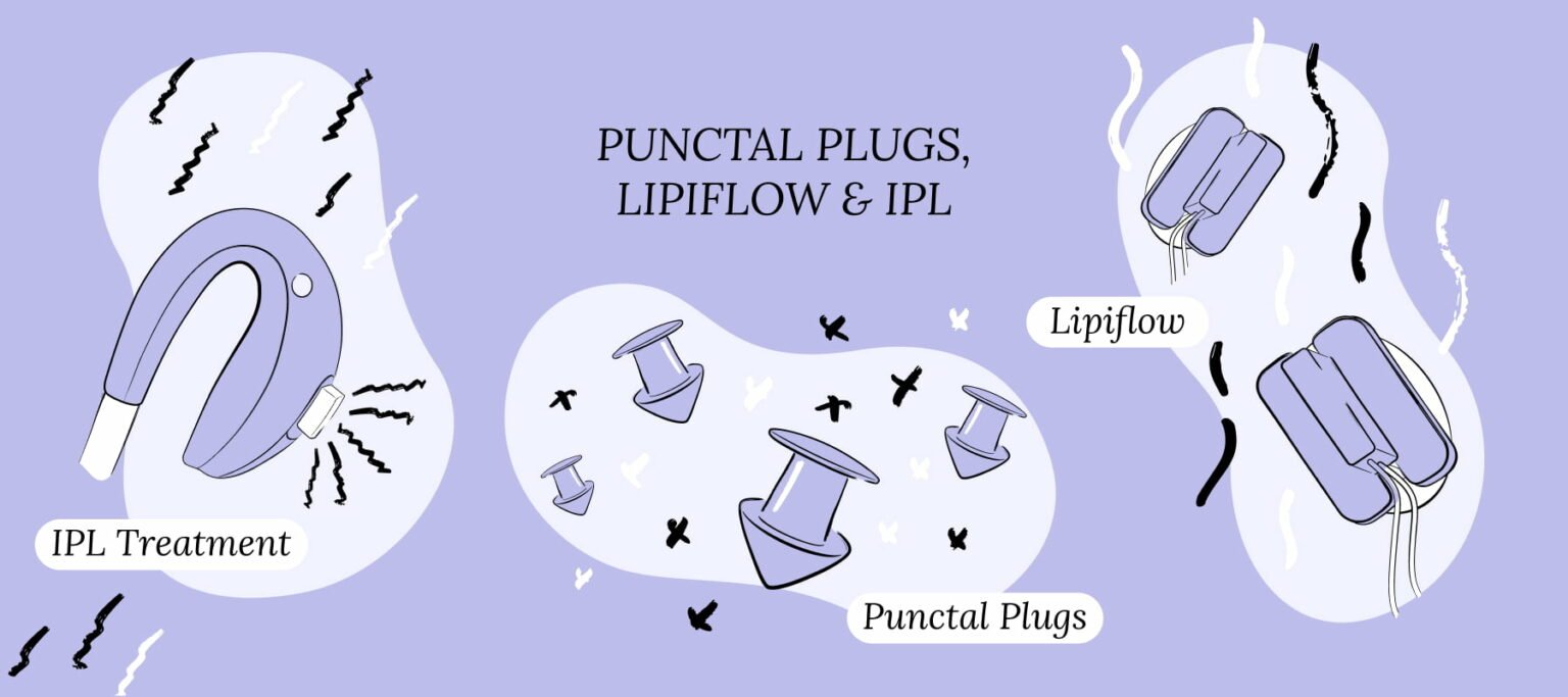 Punctal Plugs, LipiFlow, & IPL